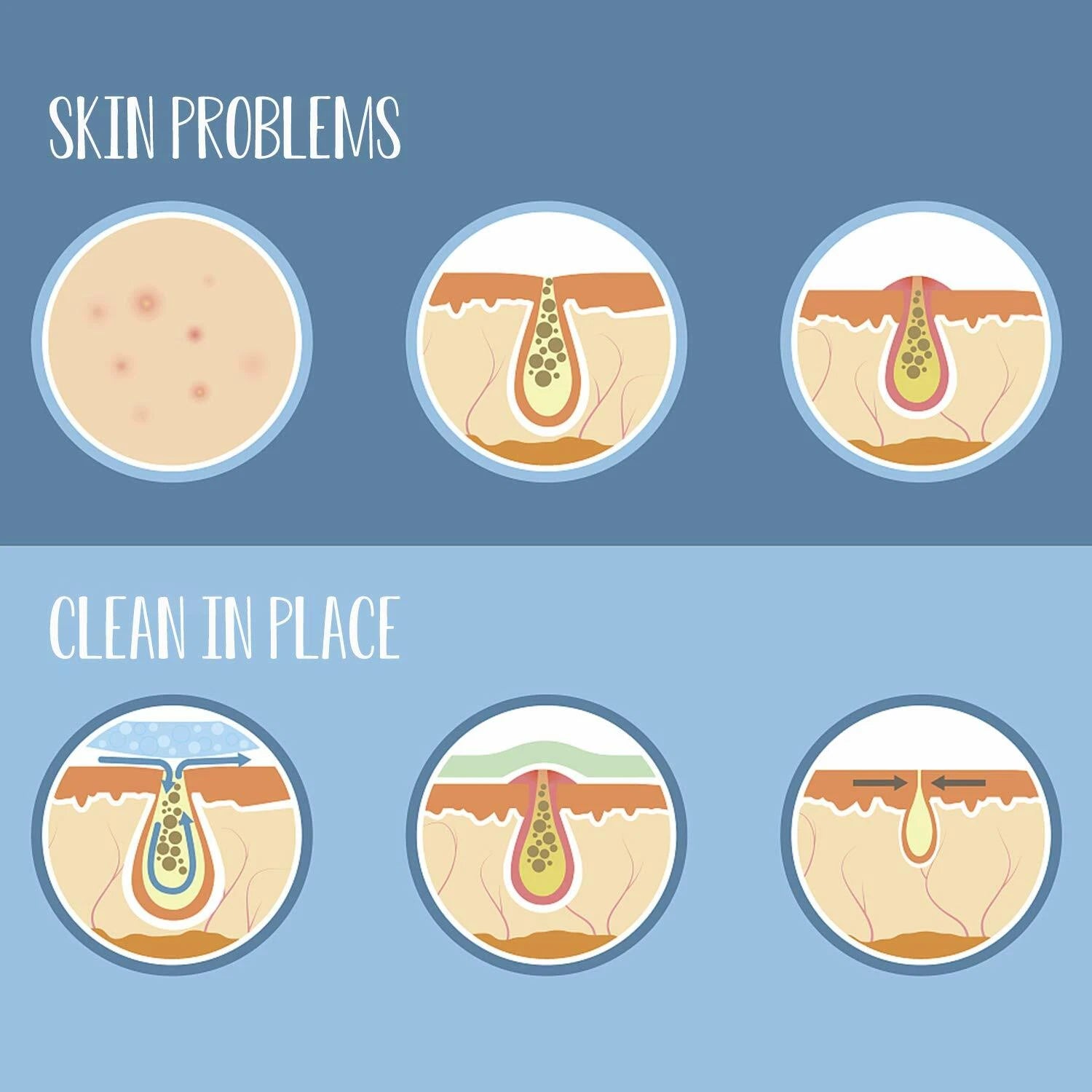 Silicone Body Scrubber Shower Bath Body Brush for Men Women Washer Exfoliating